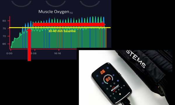 Recovery-Systems-leg-compression atom calf and arm pump