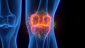 3d illustration knee inflammation joint