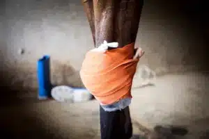 Horse Injuries